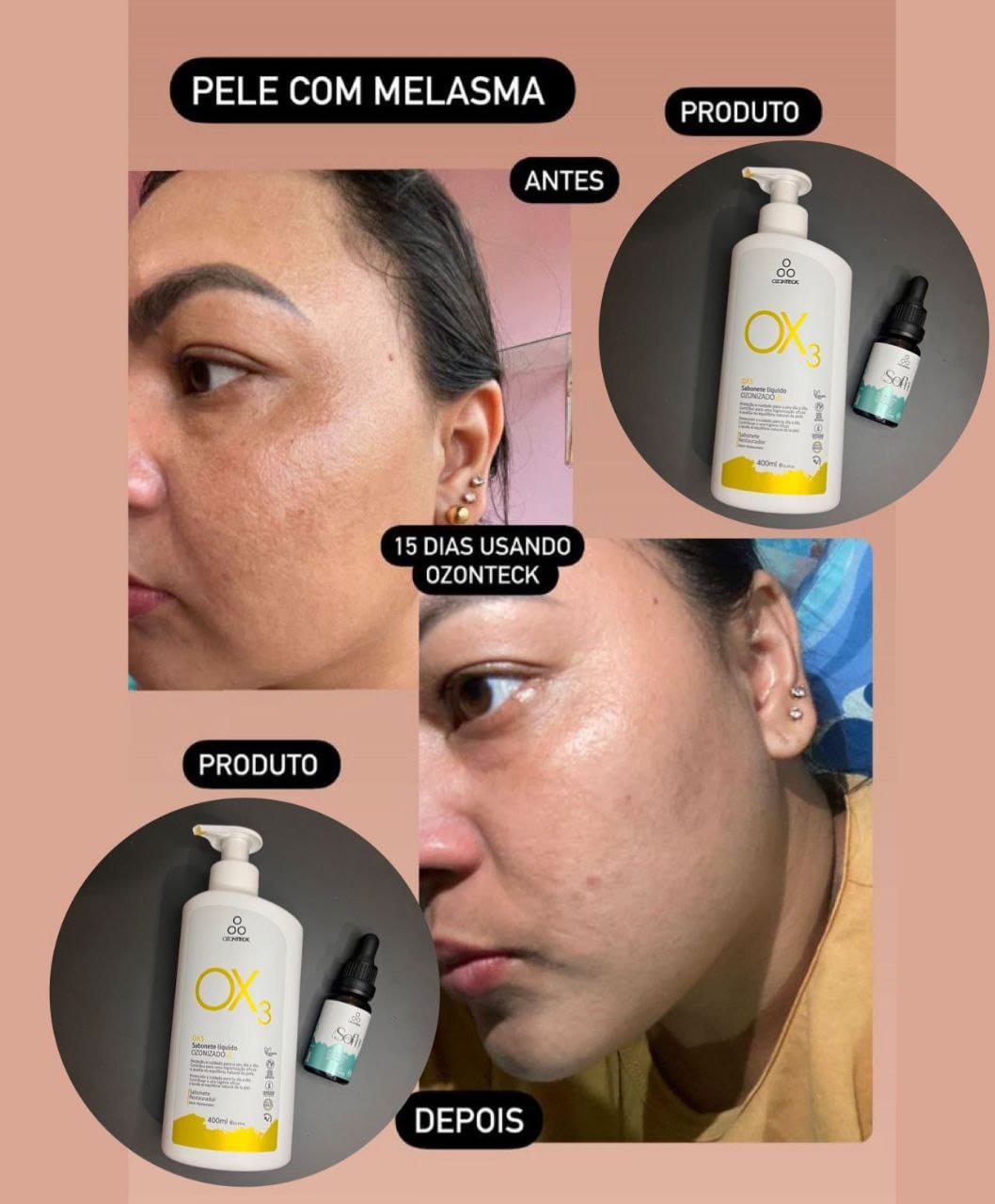 Antes e depois cliente 3